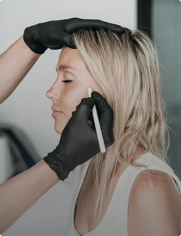 Close-up profile of a woman with blonde hair receiving a facial marking from a clinician in black gloves.