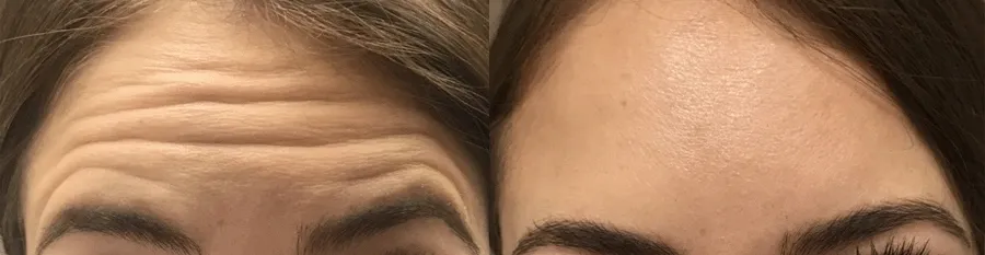wrinkles-01-1-1-fixed